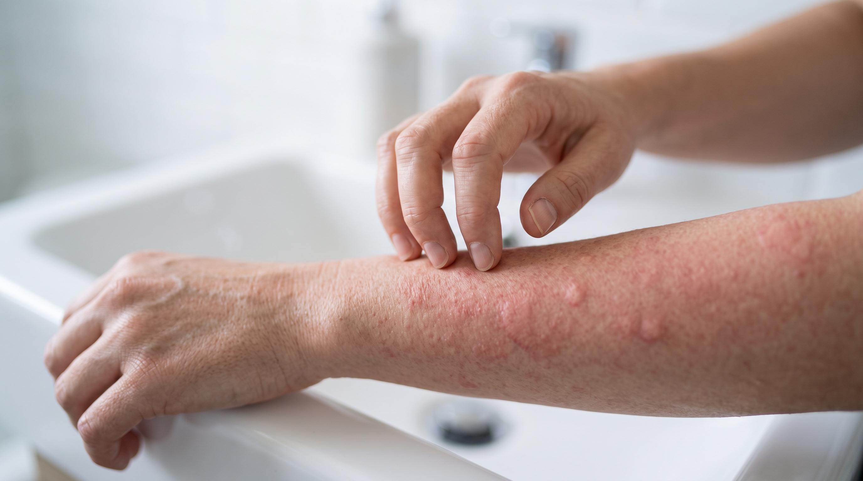 A person looking at a red, flushed patch of skin on their forearm